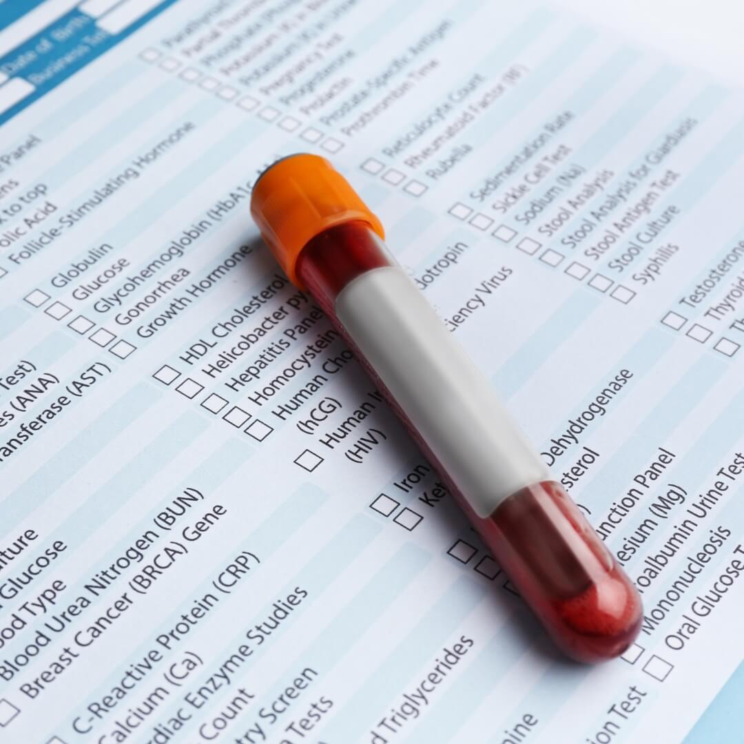 TRT Blood Work